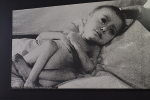 Child Victim_Nazi Experiments