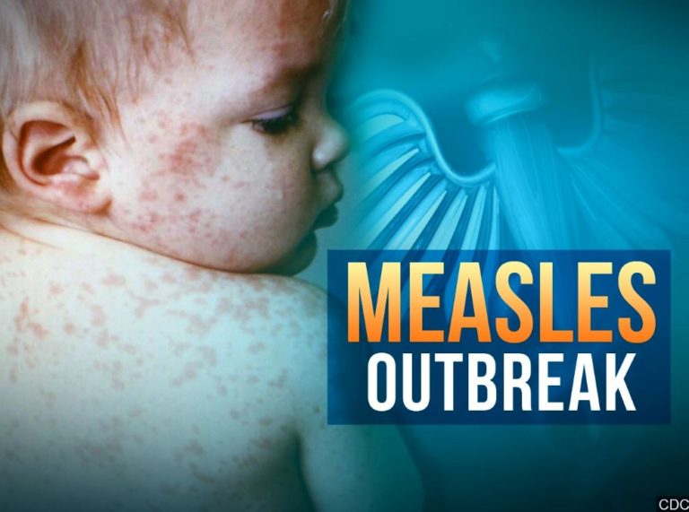 Maine’s first case of measles in 2 years is a fully Vaccinated Child